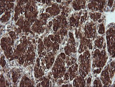 Immunohistochemistry (Formalin/PFA-fixed paraffin-embedded sections) - Anti-TRIM44 antibody [OTI1E10] (AB236422)