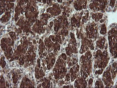 Immunohistochemistry (Formalin/PFA-fixed paraffin-embedded sections) - Anti-TRIM44 antibody [OTI1E10] (AB236422)