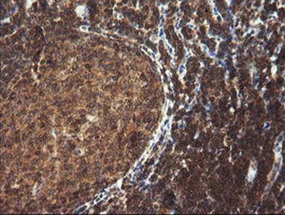 Immunohistochemistry (Formalin/PFA-fixed paraffin-embedded sections) - Anti-TRIM44 antibody [OTI1E10] (AB236422)