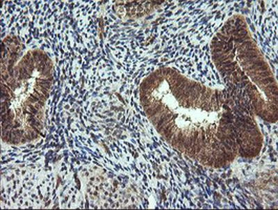 Immunohistochemistry (Formalin/PFA-fixed paraffin-embedded sections) - Anti-TRIM44 antibody [OTI1E10] (AB236422)