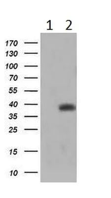 Western blot - Anti-TRIM44 antibody [OTI1E10] (AB236422)