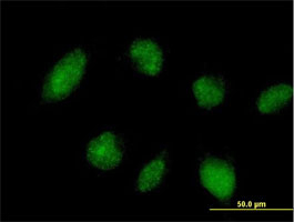 Immunocytochemistry/ Immunofluorescence - Anti-TRIM45 antibody (AB169036), expandable thumbnail