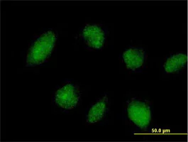 Immunocytochemistry/ Immunofluorescence - Anti-TRIM45 antibody (AB169036)