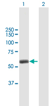 Western blot - Anti-TRIM45 antibody (AB169036), expandable thumbnail