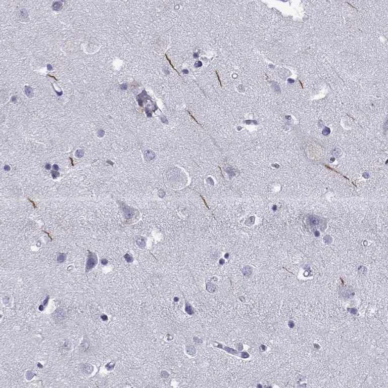 Immunohistochemistry (Formalin/PFA-fixed paraffin-embedded sections) - Anti-TRIM46 antibody (AB254941)