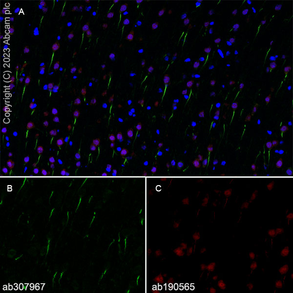 Anti-TRIM46 antibody [EPR26957-34] - BSA and Azide free