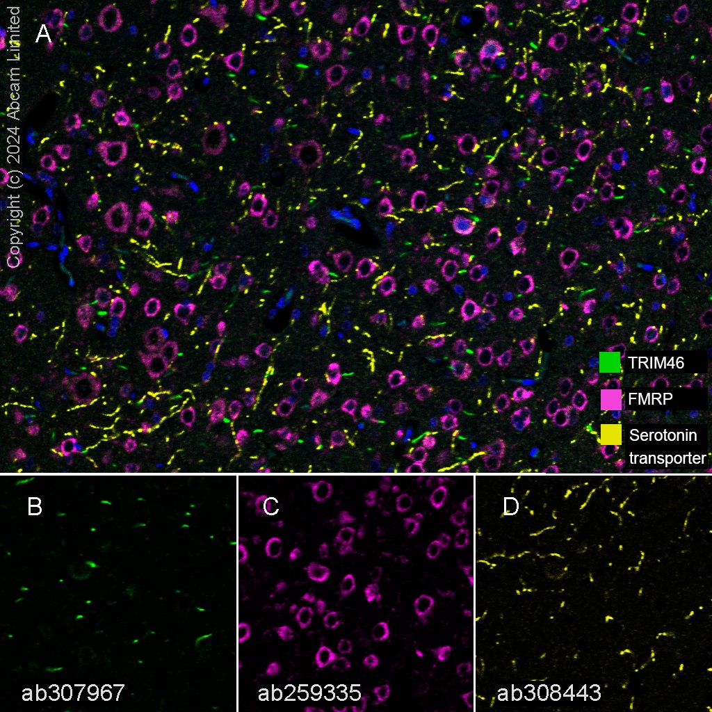 Multiplex immunohistochemistry - Anti-TRIM46 antibody [EPR26957-34] - BSA and Azide free (AB307968), expandable thumbnail