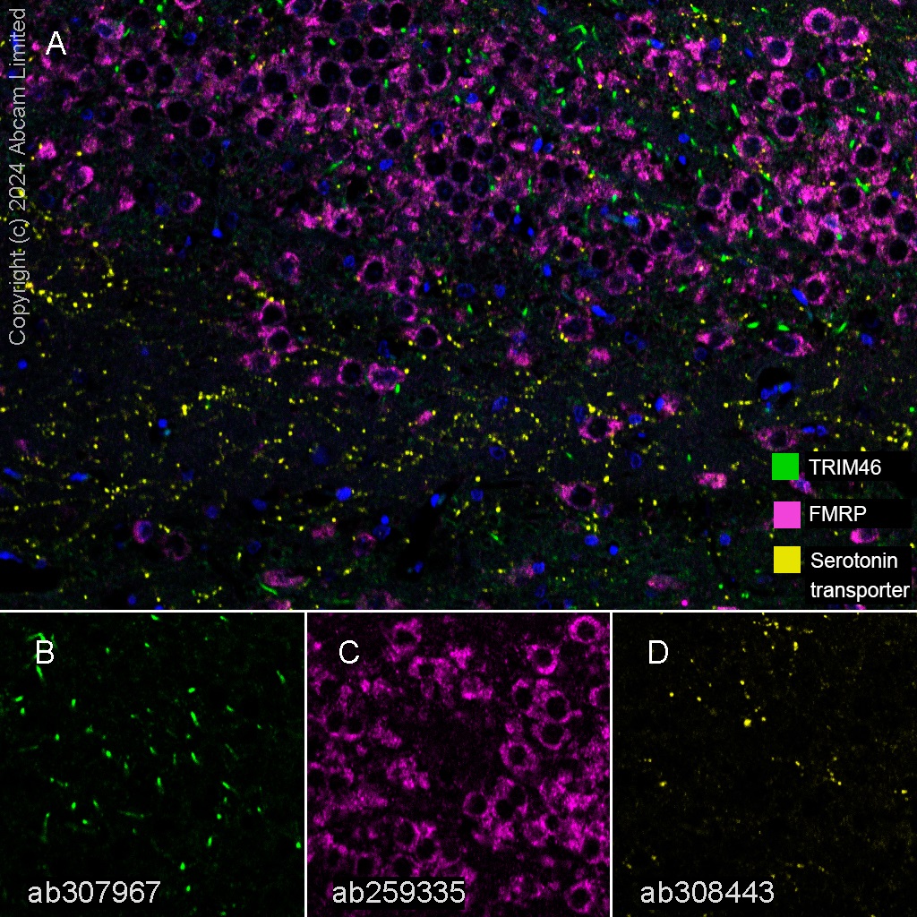 Multiplex immunohistochemistry - Anti-TRIM46 antibody [EPR26957-34] - BSA and Azide free (AB307968), expandable thumbnail