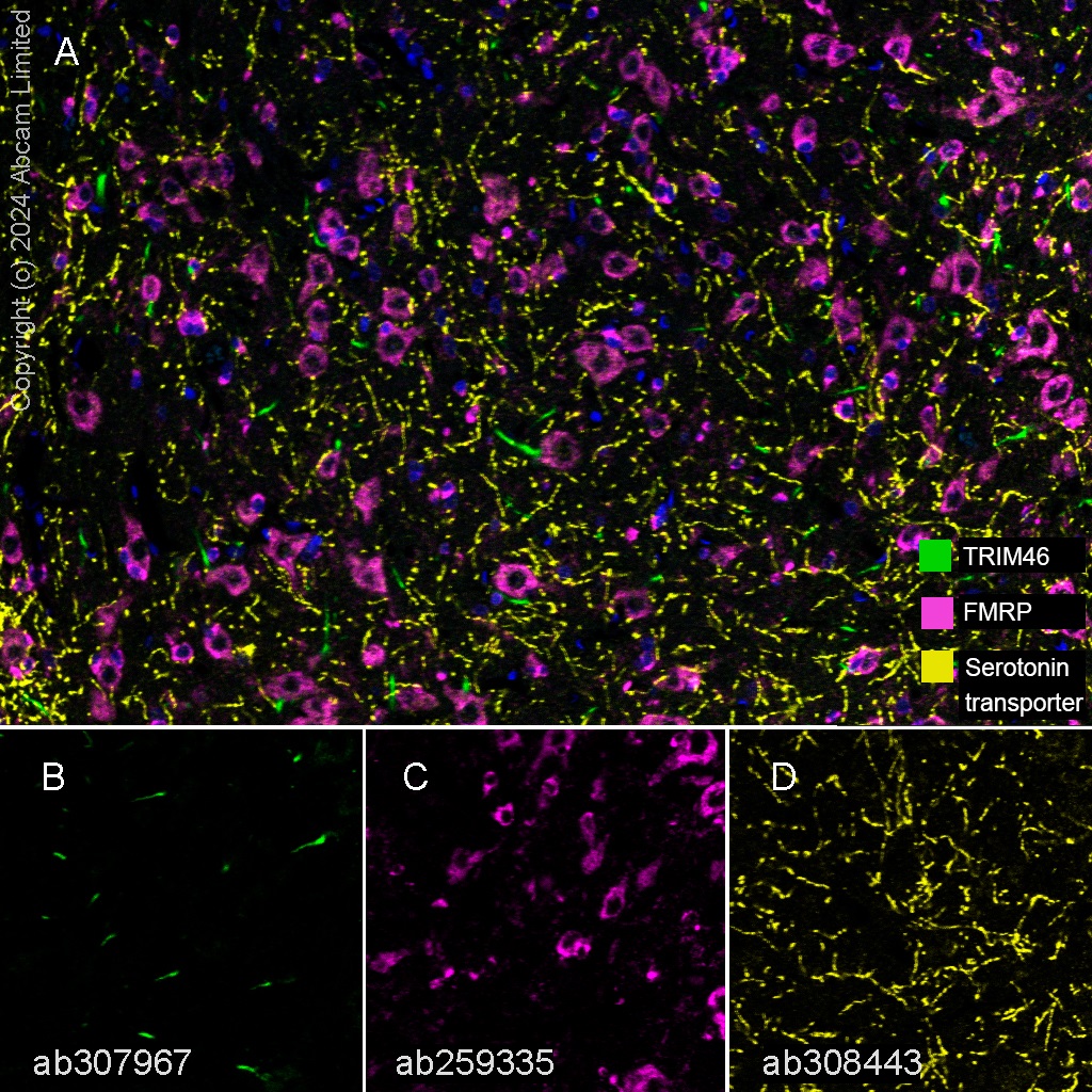Multiplex immunohistochemistry - Anti-TRIM46 antibody [EPR26957-34] - BSA and Azide free (AB307968), expandable thumbnail