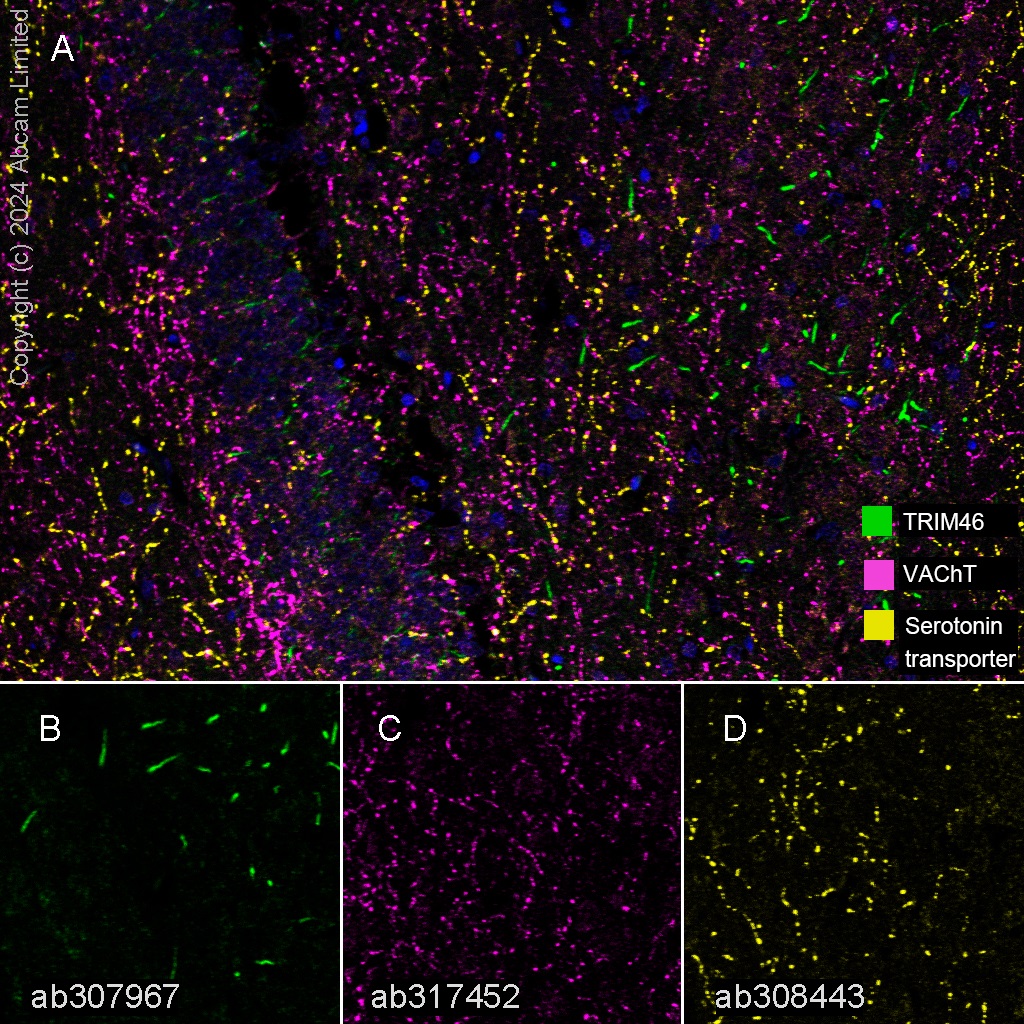 Multiplex immunohistochemistry - Anti-TRIM46 antibody [EPR26957-34] - BSA and Azide free (ab307968), expandable thumbnail