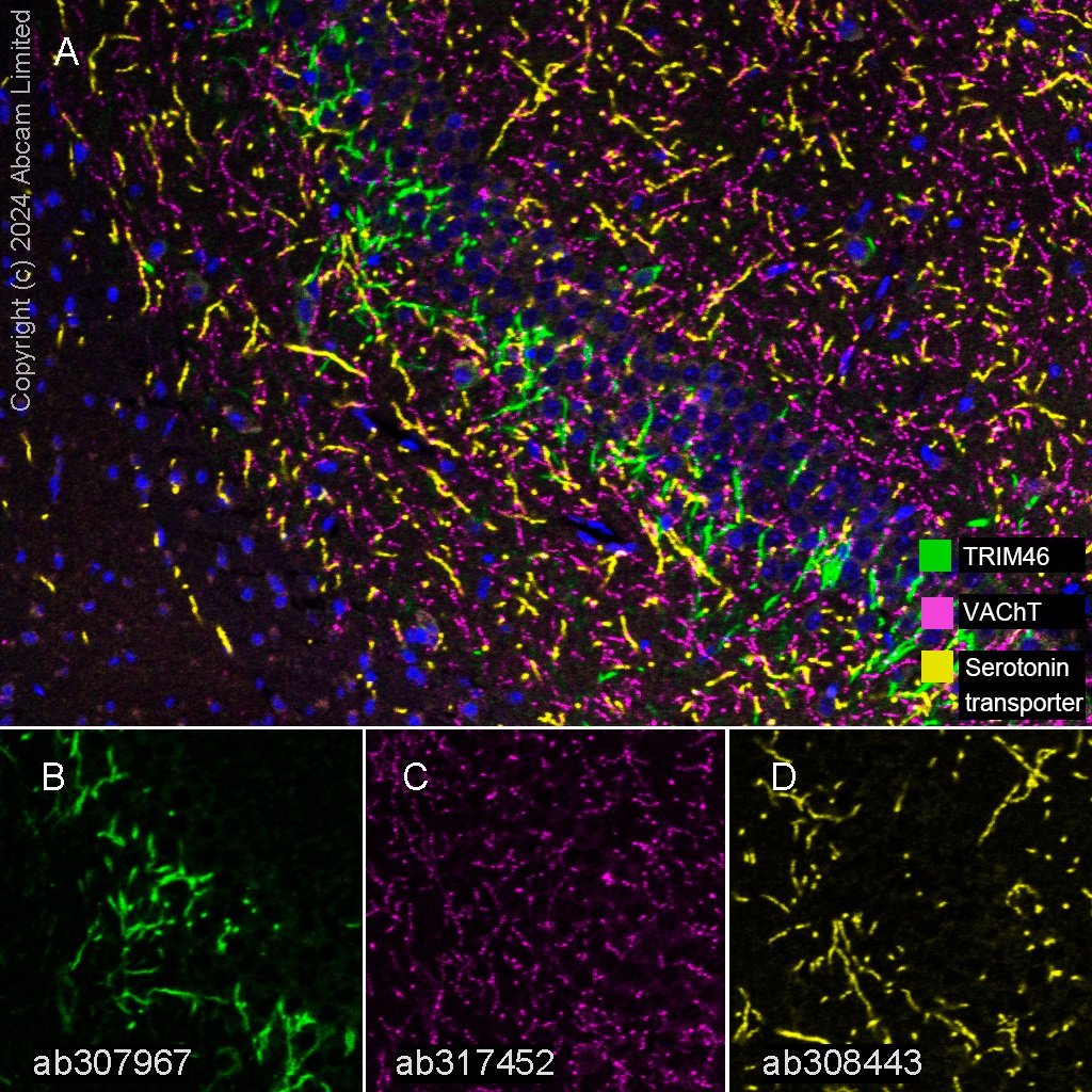 Multiplex immunohistochemistry - Anti-TRIM46 antibody [EPR26957-34] - BSA and Azide free (ab307968), expandable thumbnail
