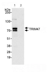 Immunoprecipitation - Anti-TRIM47 antibody (AB72234)