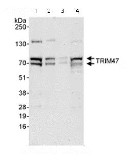 Western blot - Anti-TRIM47 antibody (AB72234)