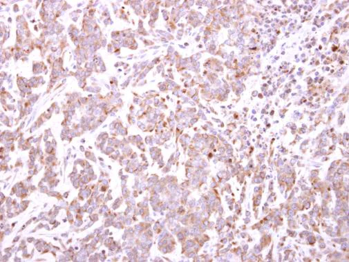 Immunohistochemistry (Formalin/PFA-fixed paraffin-embedded sections) - Anti-TRIM49 antibody (AB229152)
