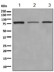 Western blot - Anti-TRIM56 antibody [EPR10582] (AB154821)