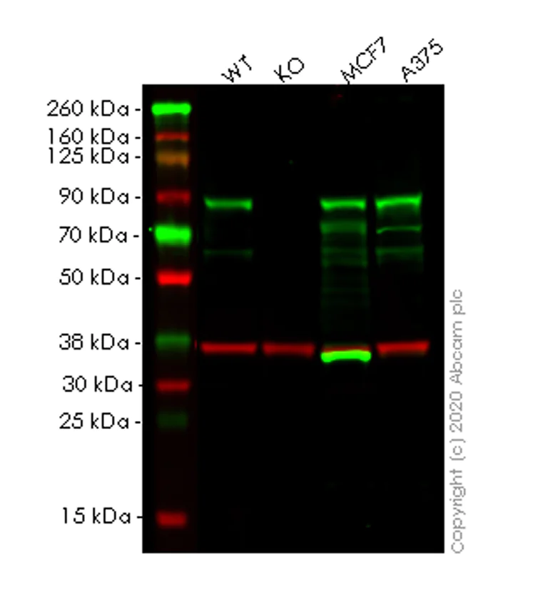 Western blot - Anti-TRIM56 antibody [EPR10582] (AB154821)