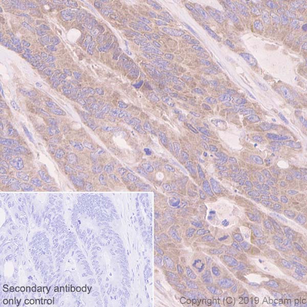 Immunohistochemistry (Formalin/PFA-fixed paraffin-embedded sections) - Anti-TRIM56 antibody [EPR10583] (AB154862), expandable thumbnail