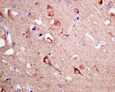 Immunohistochemistry (Formalin/PFA-fixed paraffin-embedded sections) - Anti-TRIM56 antibody [EPR10583] (ab154862), expandable thumbnail