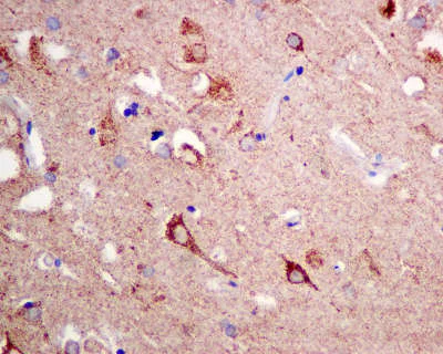 Immunohistochemistry (Formalin/PFA-fixed paraffin-embedded sections) - Anti-TRIM56 antibody [EPR10583] (AB154862)