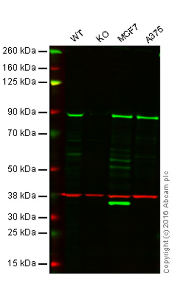 Western blot - Anti-TRIM56 antibody [EPR10583] (ab154862), expandable thumbnail