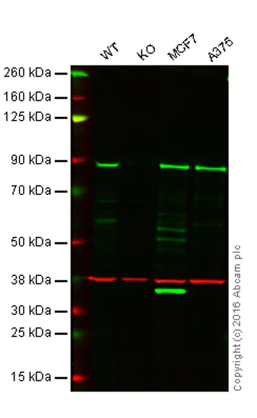 Western blot - Anti-TRIM56 antibody [EPR10583] (AB154862)