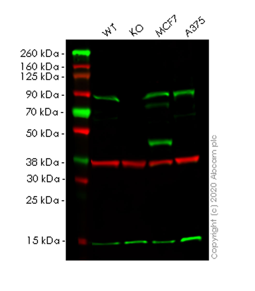 Western blot - Anti-TRIM56 antibody [EPR10583] (AB154862), expandable thumbnail