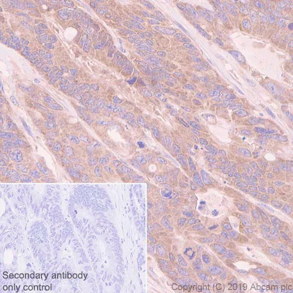 Immunohistochemistry (Formalin/PFA-fixed paraffin-embedded sections) - Anti-TRIM56 antibody [EPR10583] - BSA and Azide free (AB249161)