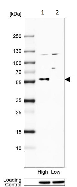 Western blot - Anti-TRIM58 antibody (AB254768)