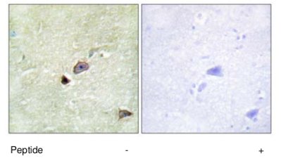 Immunohistochemistry (Formalin/PFA-fixed paraffin-embedded sections) - Anti-TRIM59 antibody (AB69639)