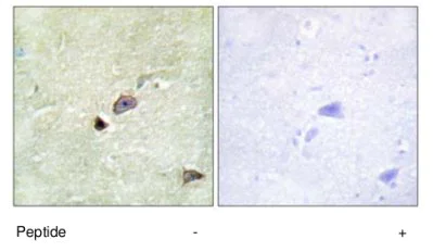 Immunohistochemistry (Formalin/PFA-fixed paraffin-embedded sections) - Anti-TRIM59 antibody (AB69639)