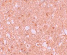 Immunocytochemistry - Anti-TRIM71/LIN41 antibody (AB105330)