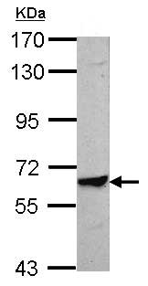 Western blot - Anti-TRIM8 antibody (AB155674), expandable thumbnail