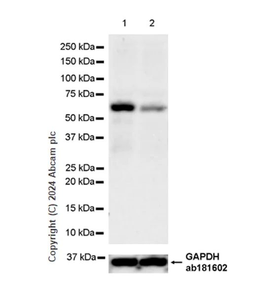 Western blot - Anti-TRIM8 antibody [EPR27965-6] (AB316149)
