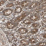 Immunohistochemistry (Formalin/PFA-fixed paraffin-embedded sections) - Anti-TRIO antibody (AB121273)