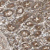 Immunohistochemistry (Formalin/PFA-fixed paraffin-embedded sections) - Anti-TRIO antibody (AB121273)