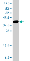 Western blot - Anti-TRIO antibody (AB194365)