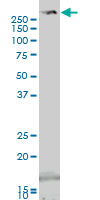 Western blot - Anti-TRIO antibody (AB194365)