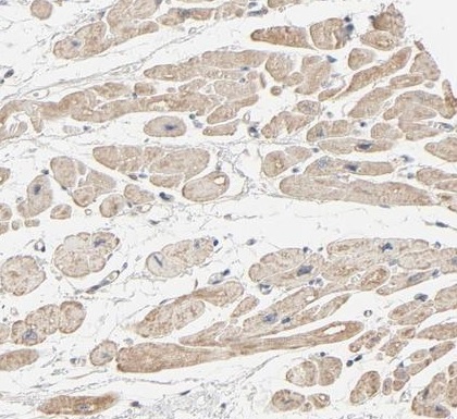 Immunohistochemistry (Formalin/PFA-fixed paraffin-embedded sections) - Anti-TRIOBP antibody (AB224226), expandable thumbnail