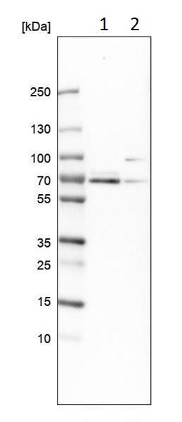 Western blot - Anti-TRIOBP antibody (AB224226), expandable thumbnail