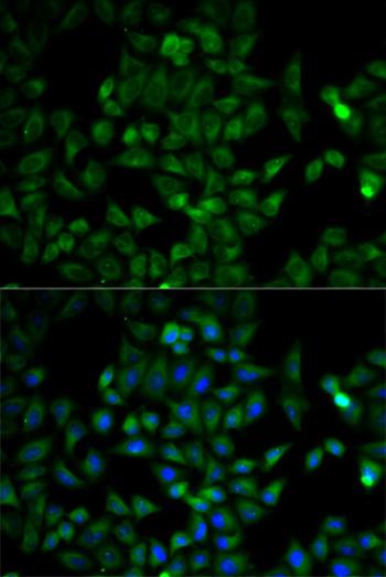 Immunocytochemistry/ Immunofluorescence - Anti-Triosephosphate isomerase antibody (AB196618)