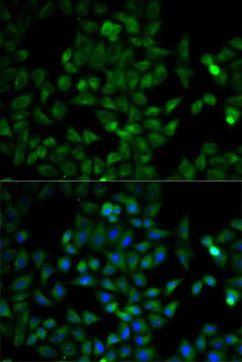 Immunocytochemistry/ Immunofluorescence - Anti-Triosephosphate isomerase antibody (AB196618)