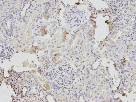 Immunohistochemistry (Formalin/PFA-fixed paraffin-embedded sections) - Anti-Triosephosphate isomerase antibody (AB196618)