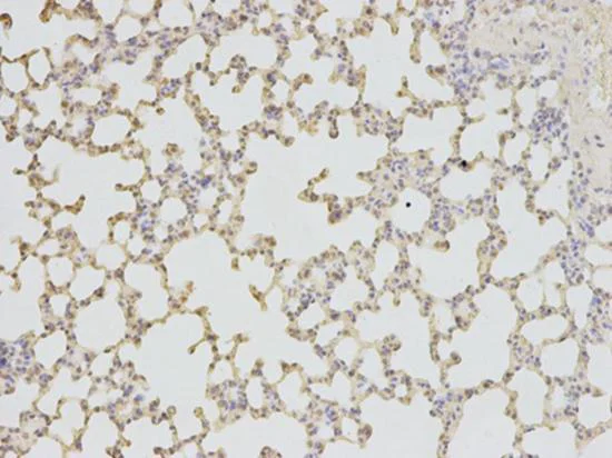 Immunohistochemistry (Formalin/PFA-fixed paraffin-embedded sections) - Anti-Triosephosphate isomerase antibody (AB196618)