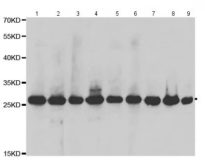 Western blot - Anti-Triosephosphate isomerase antibody (AB196618)