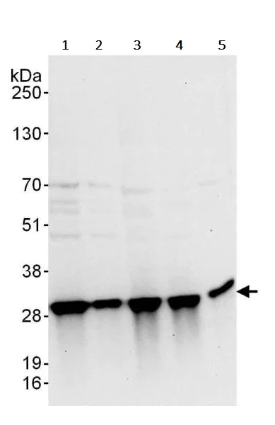 Western blot - Anti-Triosephosphate isomerase antibody (AB240599)