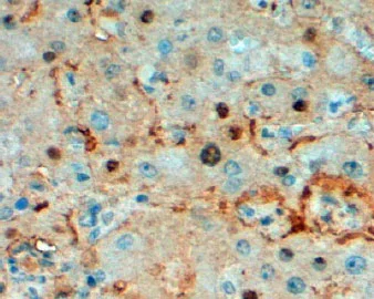 Immunohistochemistry (Formalin/PFA-fixed paraffin-embedded sections) - Anti-Triosephosphate isomerase antibody (AB28760)
