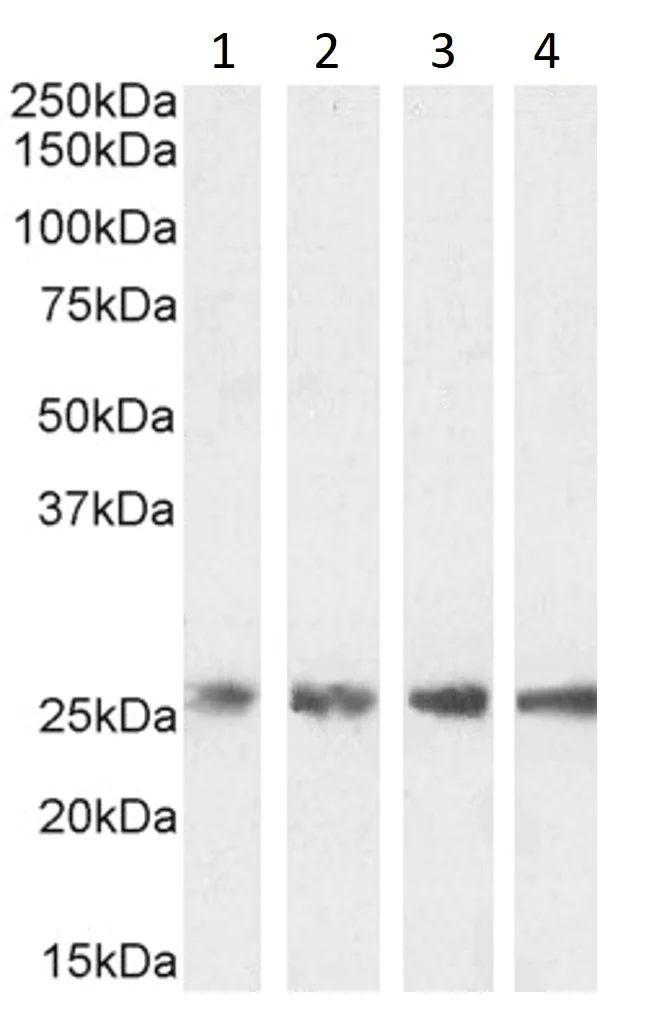 Western blot - Anti-Triosephosphate isomerase antibody (AB28760)