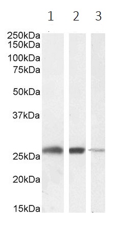 Western blot - Anti-Triosephosphate isomerase antibody (AB28760), expandable thumbnail