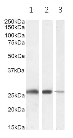 Western blot - Anti-Triosephosphate isomerase antibody (AB28760)