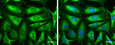 Immunocytochemistry/ Immunofluorescence - Anti-Triosephosphate isomerase antibody (AB96696)